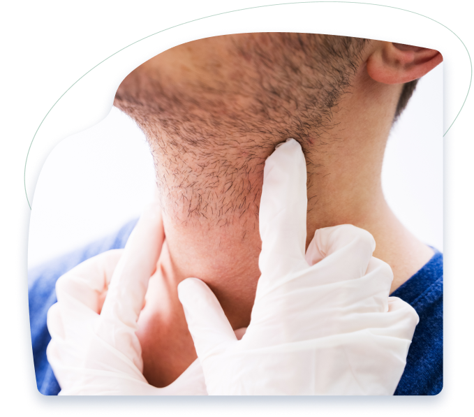 Salivary Gland Disorders