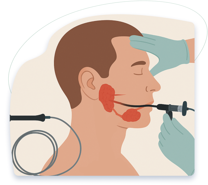 Sialendoscopy