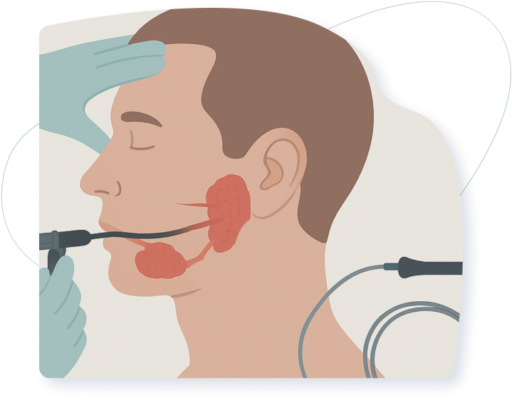 Why Patients Choose Sialendoscopy png