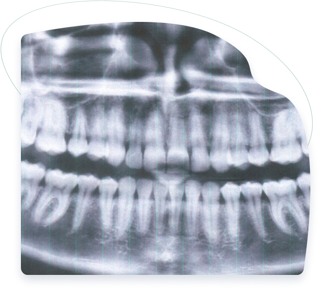 tmj disorders